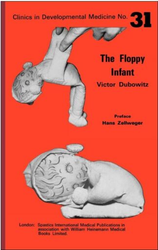 The Floppy Infant