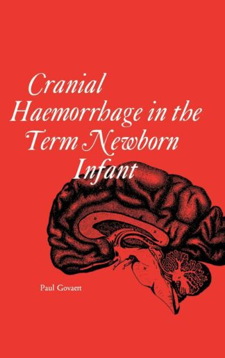 Cranial Haemorrhage in the Term Newborn lnfant