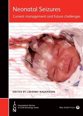Neonatal Seizures (ebook)