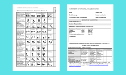 Product image for Hammersmith Neurological Examinations