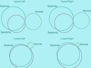 Dyskinetic Cerebral Palsy Virtual Issue