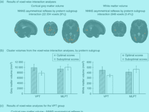 Neonatal Neurology Virtual Issue