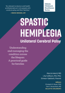 Spastic Hemiplegia–Unilateral Cerebral Palsy