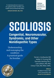 The cover of the book Scoliosis